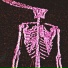 Killzxd