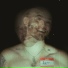 Frankie IV