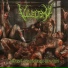 Vulvectomy