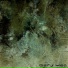 anomia