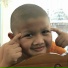 ARNUN