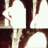 VALNI