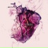 Fractures