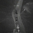Li-2c