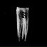 CHALK TEETH