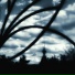 glaucoma