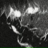 amekudeku