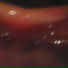 Yvu, Rosabege, Lessa Gustavo