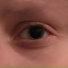 Bright Blink
