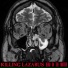 Killing Lazarus