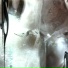 PlasticSkin