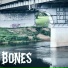 B0nes