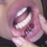 K3NN3DY