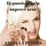 Angella Peters