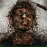 Craniotomy