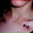 Die Die