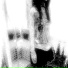 NXDNX