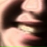 koe