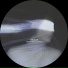 Rinzler