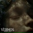 Vermos