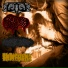 Lymphoma