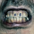 Type 5 Blood