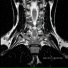 Mario Cáceres