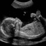 Wombsounds, Babysounds