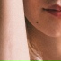 Meis