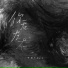 于治RayJ