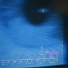 glaucoma, посмотрим