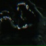 ektropion