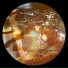 Alevoid