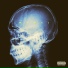 Caskey