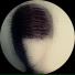 Fixon