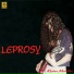 Leprosy