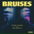 Bruises