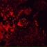 ANTIISTA
