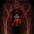 S-VOX
