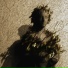 EPILEPSY