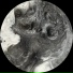 Subtraum