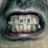 TYPE 5 BLOOD