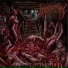 DYSMORFECTOMY