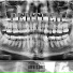 ANRO29