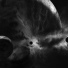 Nocturnal Depression