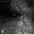 Limbo
