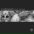 I1 Ambivalent