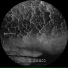 Hioll