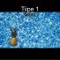 Tiipe 1