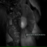 Poetry Of Thorns